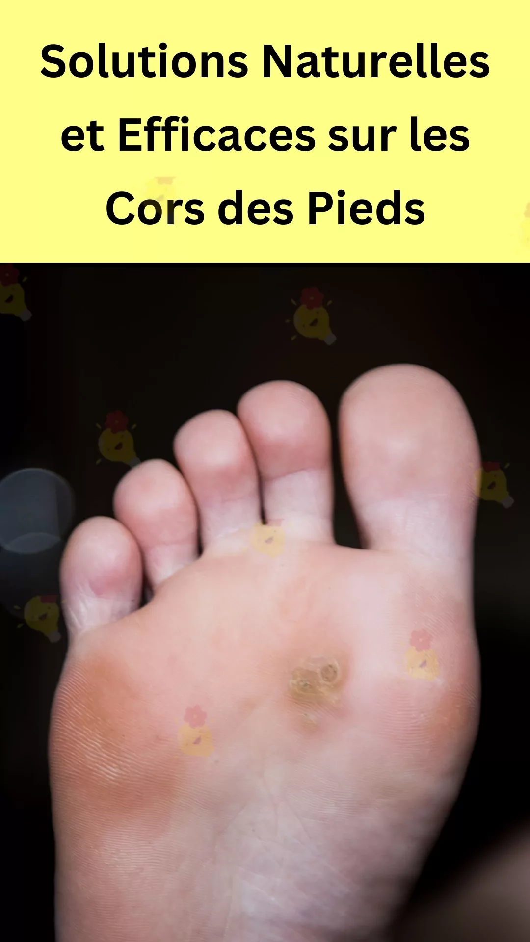 Recourir à des remèdes naturels pour soulager ses pieds
