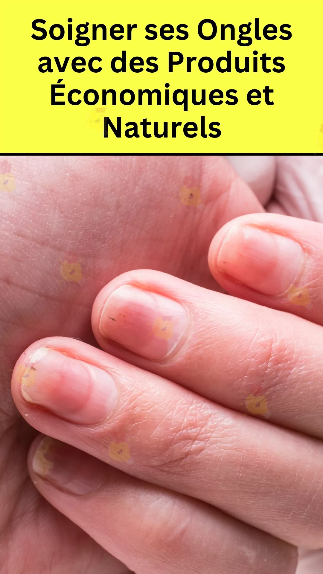 Un ongle fort avec du citron et d'autres remèdes